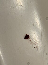 Health department needs to inspect this motel