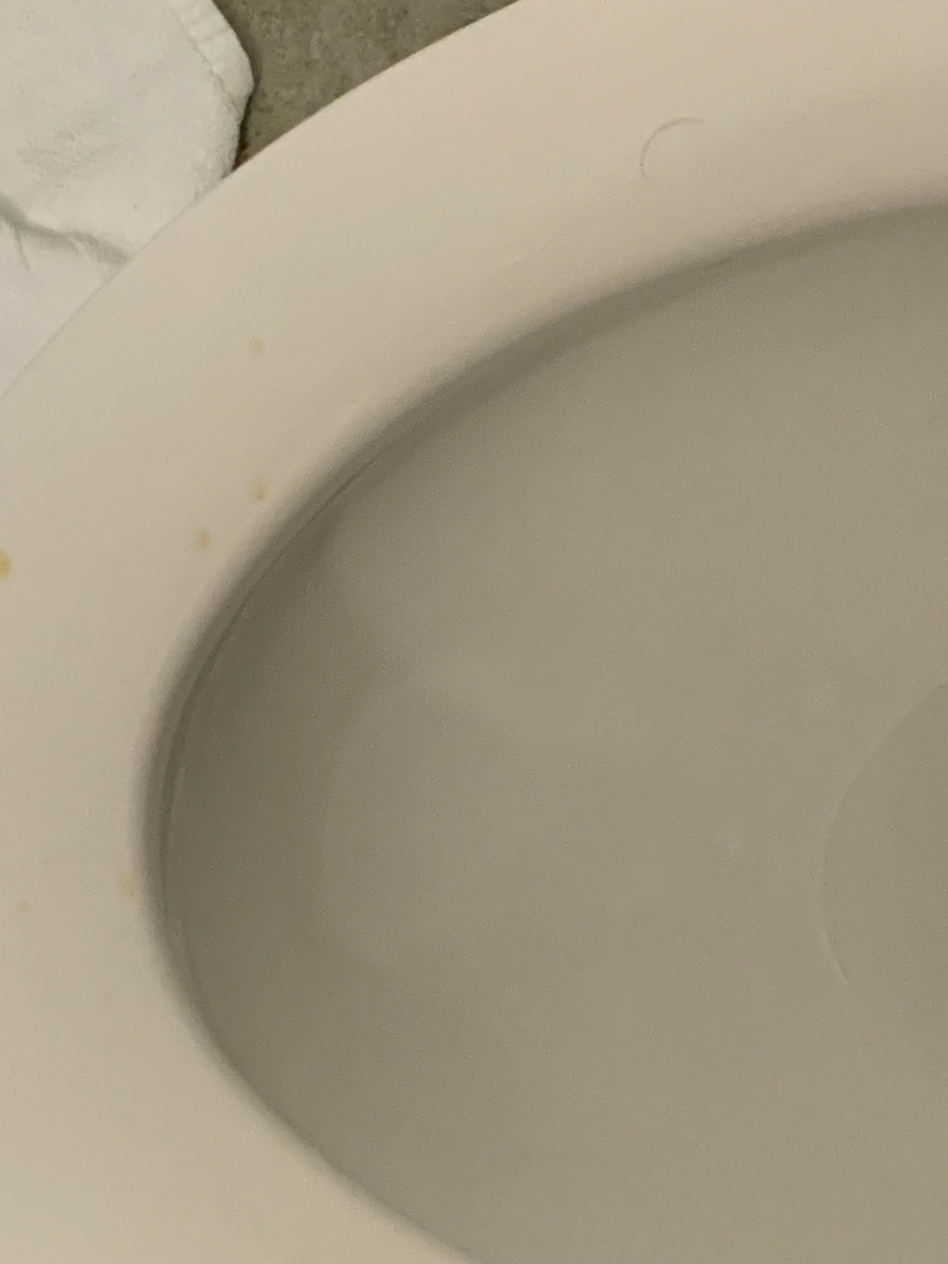 Urine stained toilet