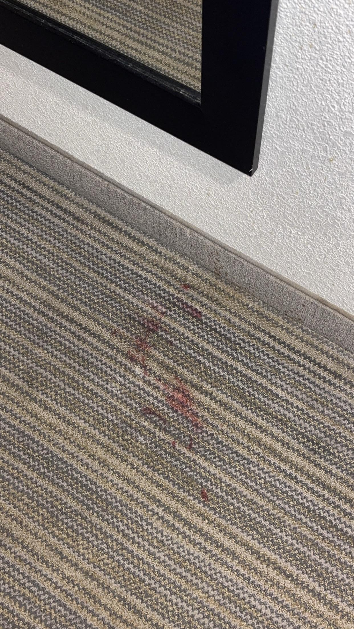 The blood stain??