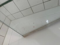 Dangerous shower door that penetrated my leg toe