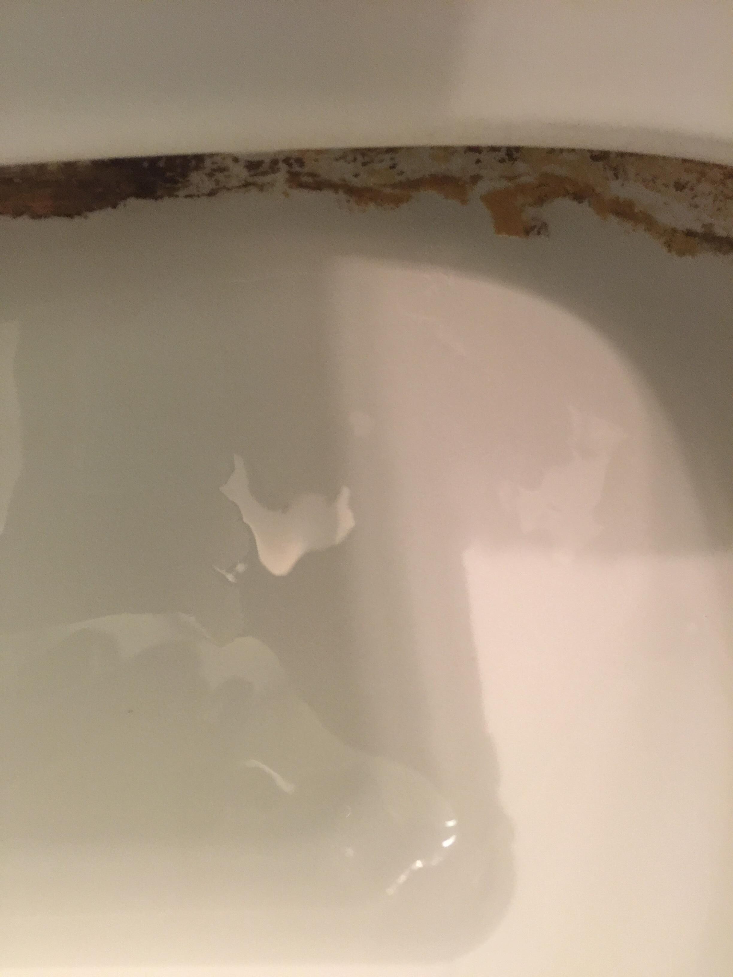 Residual fecal matter around toilet bowl