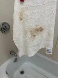 Mold from the showerhead