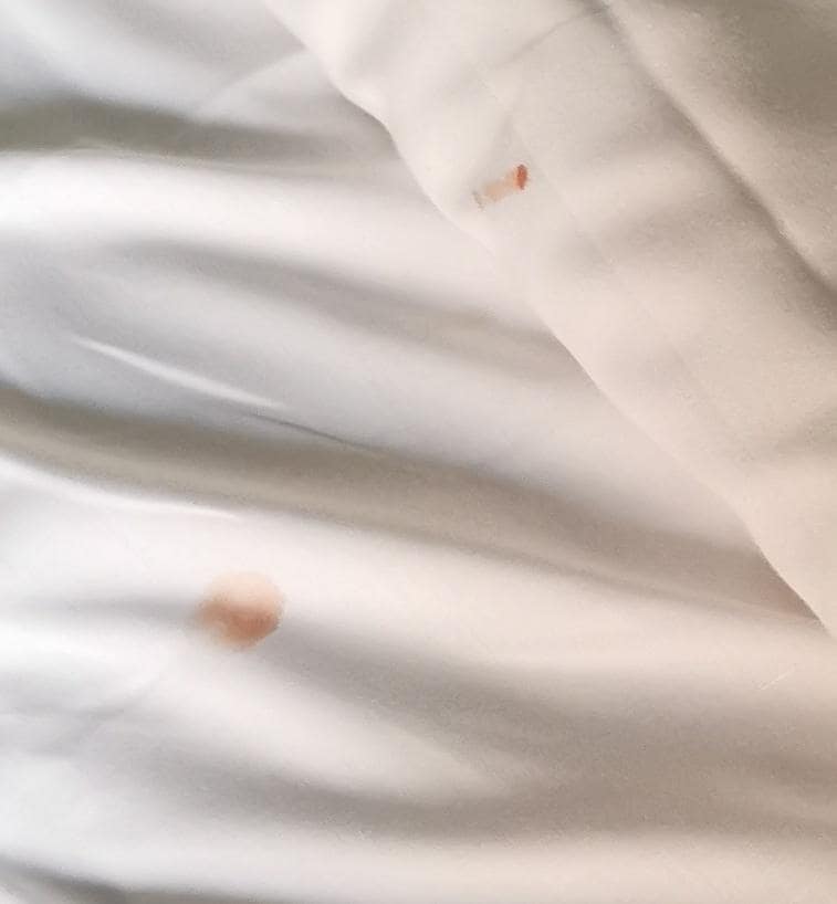 Parts of the blood splatter on my sheets