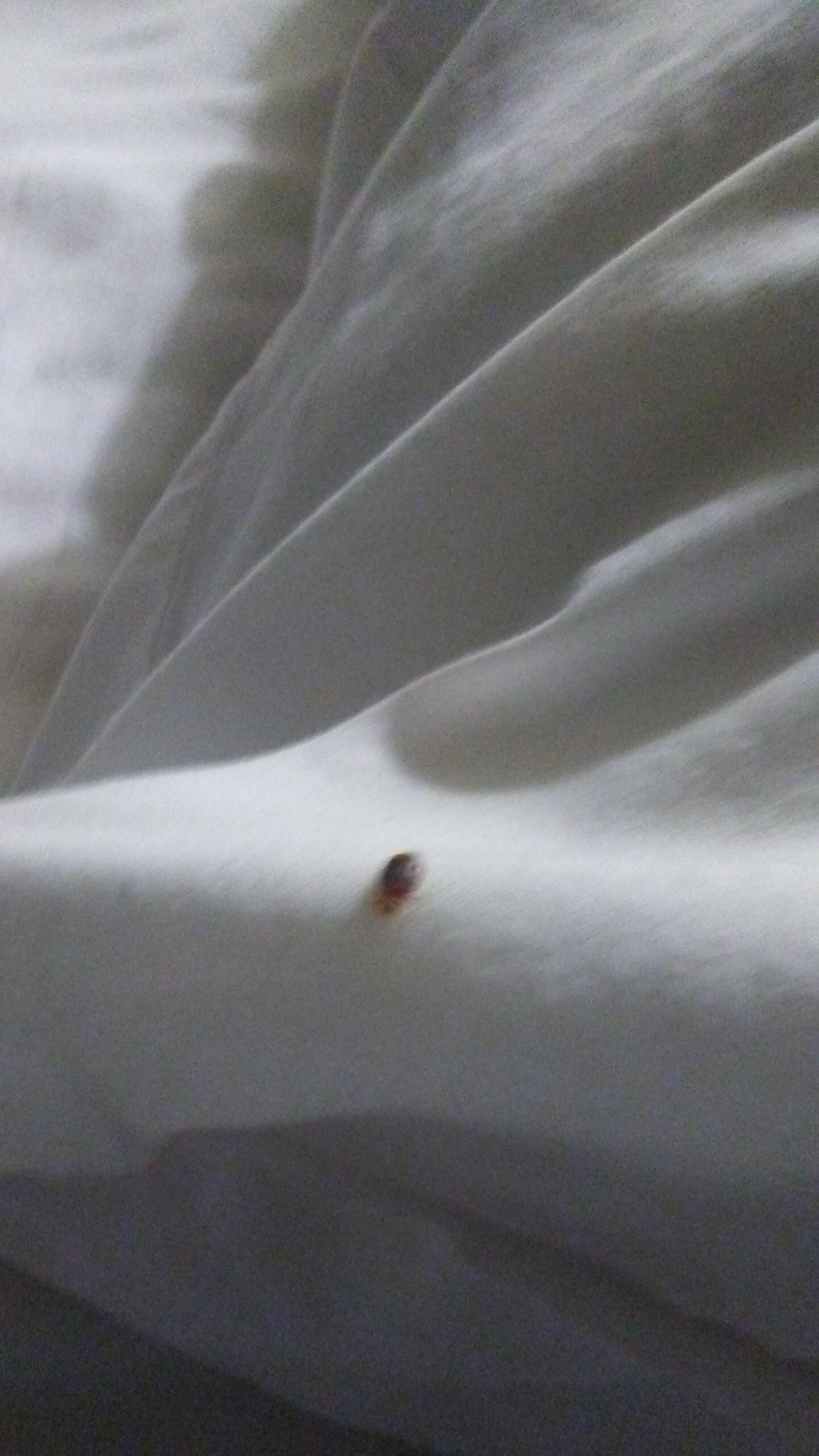 Bed bug bites