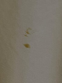 Stains on top sheets.