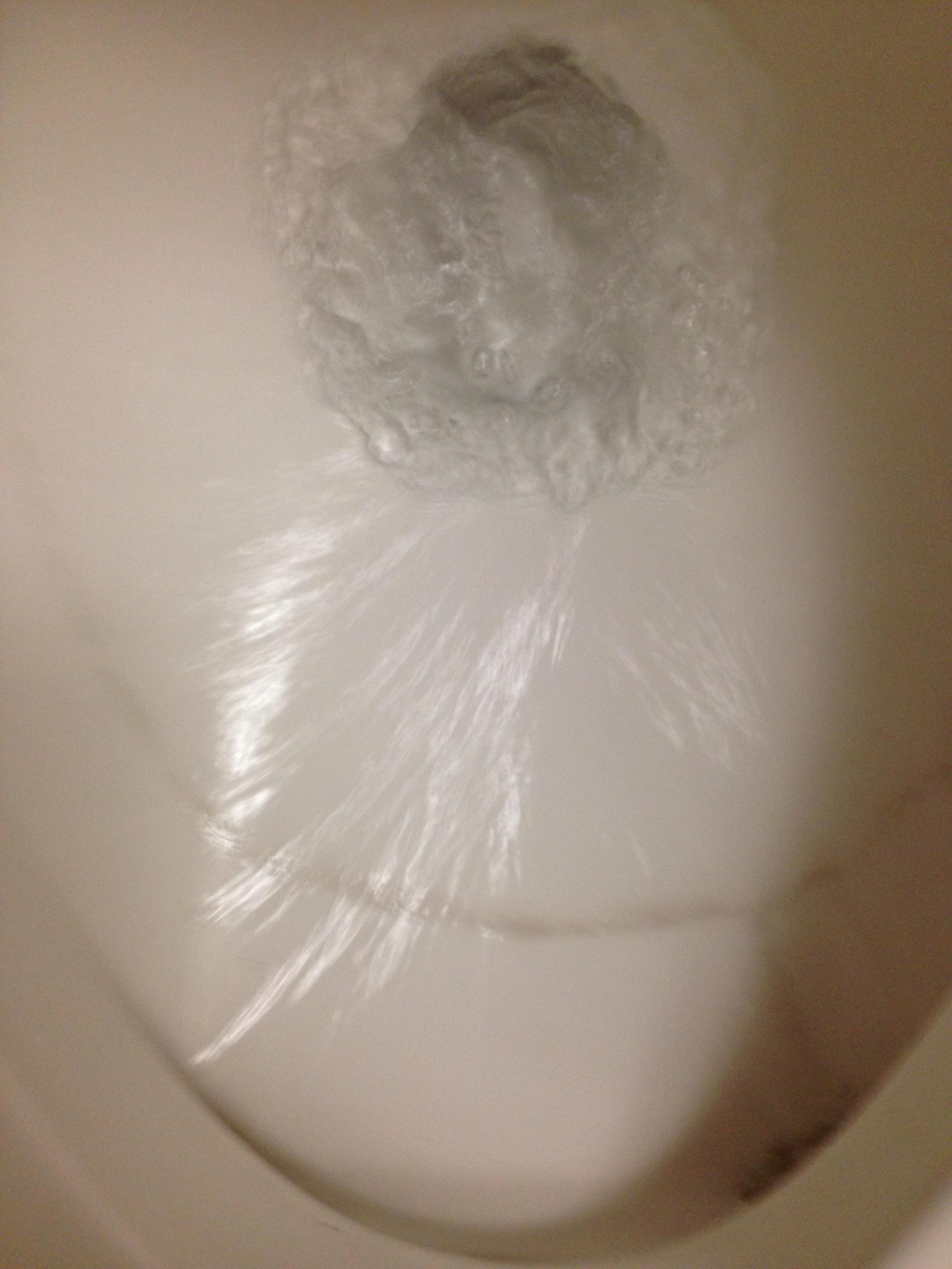 Black ring in toilet