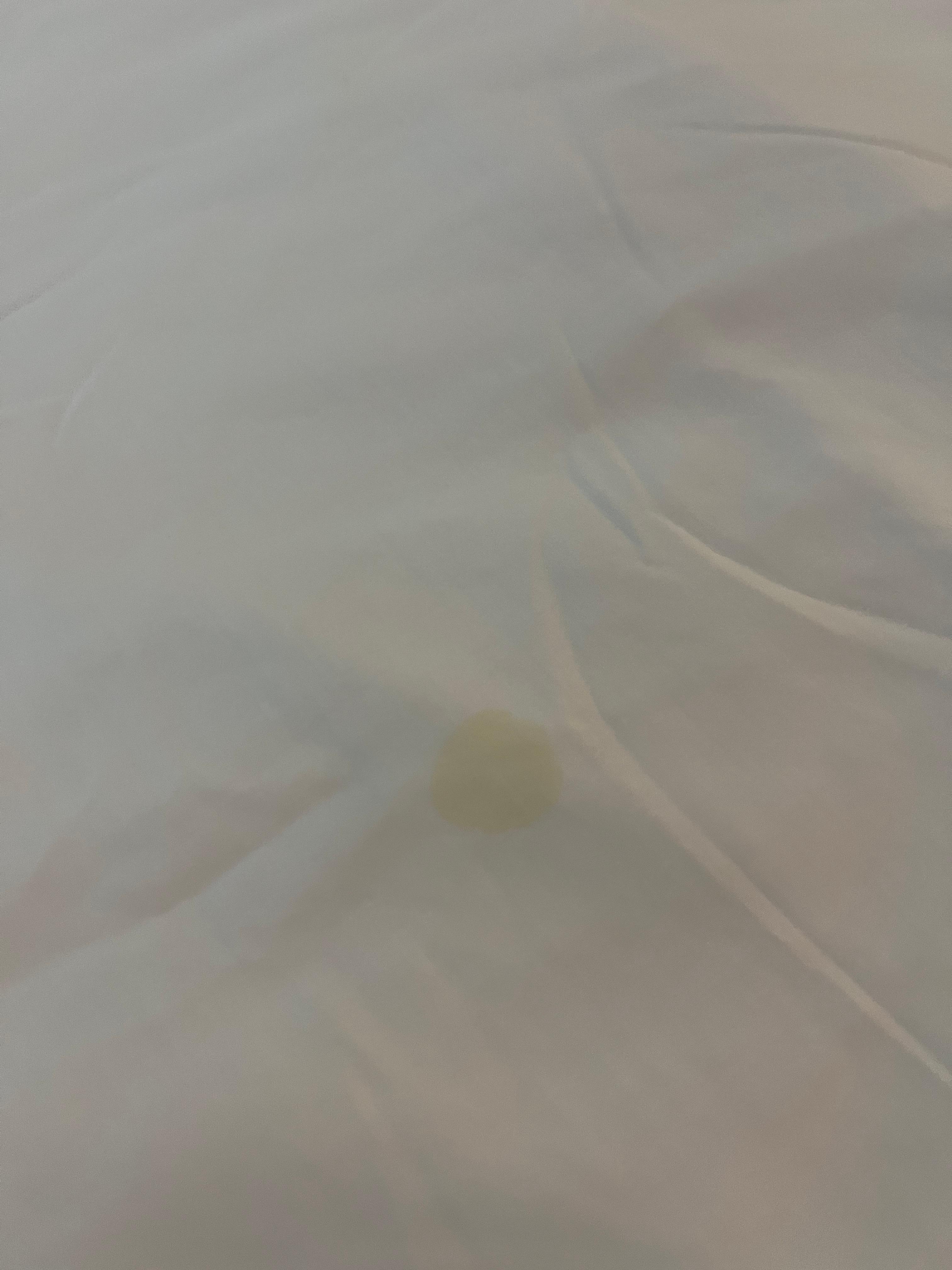 Yellow stains on the bed sheet. 