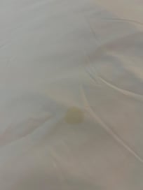 Yellow stains on the bed sheet.