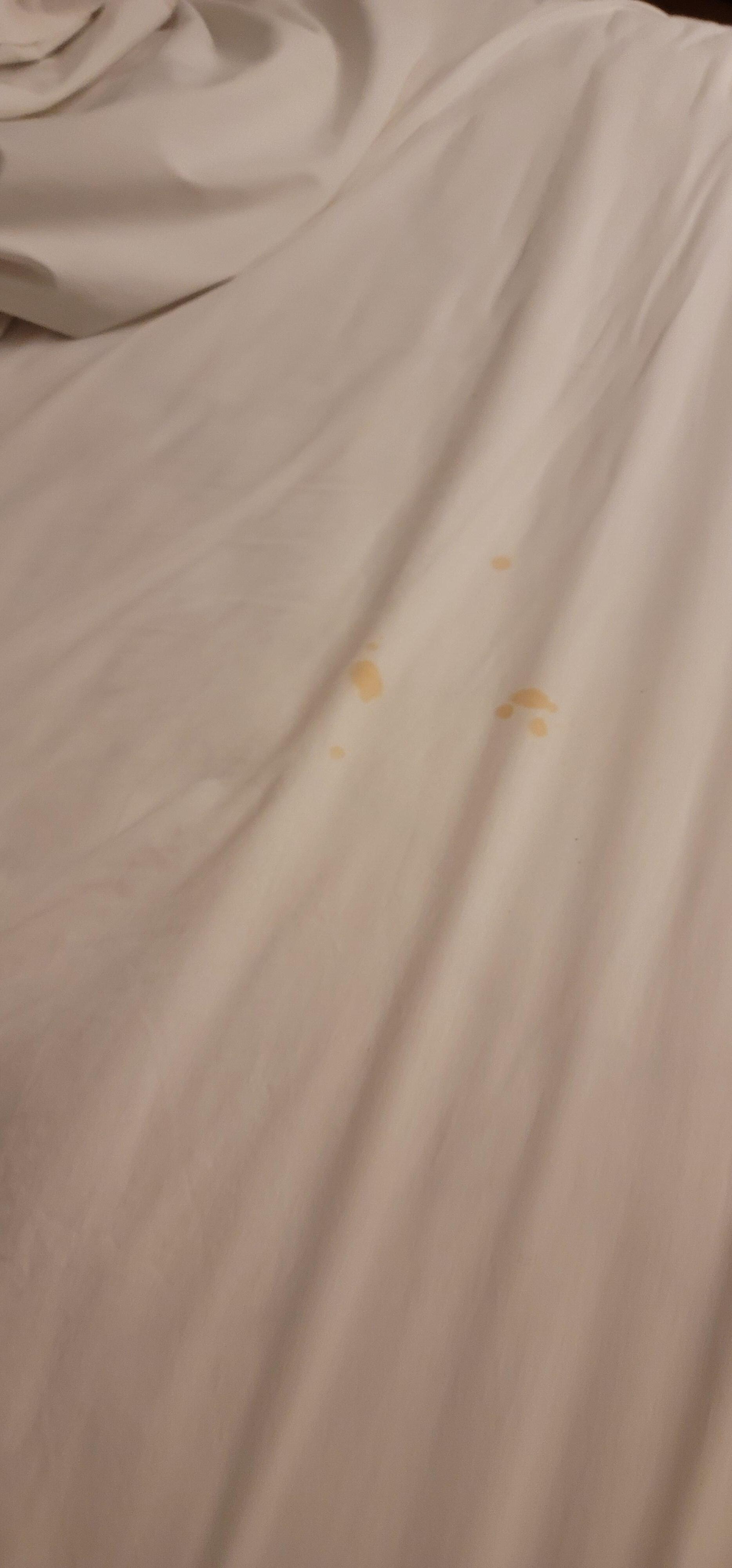 Stains on sheets