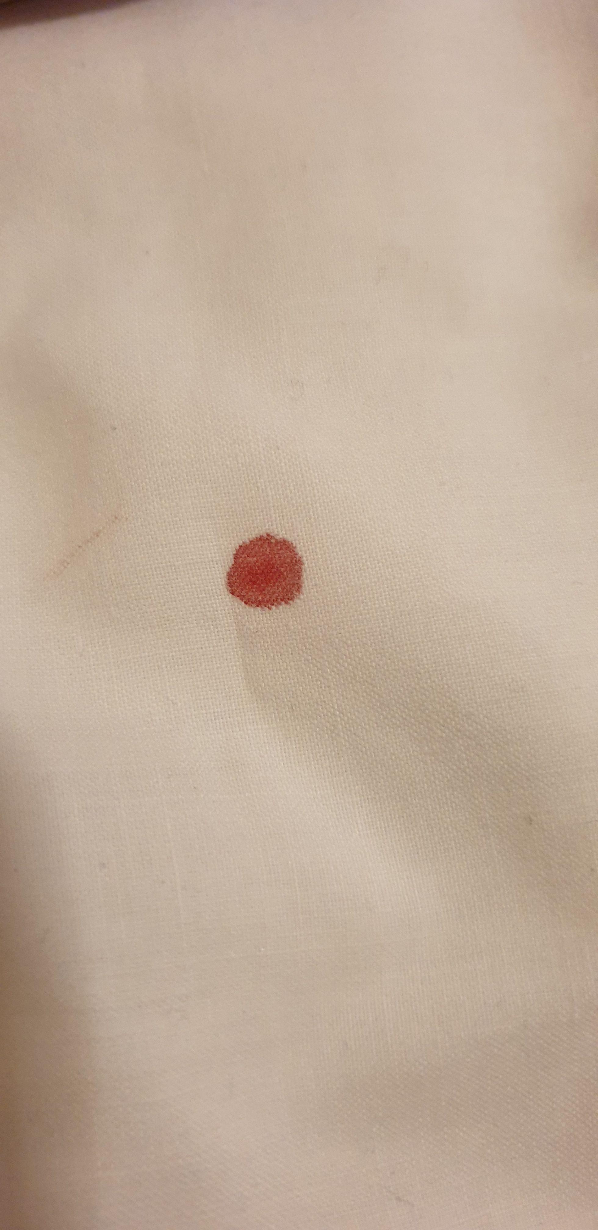 Blood on bedsheet