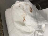 Stains on the towls