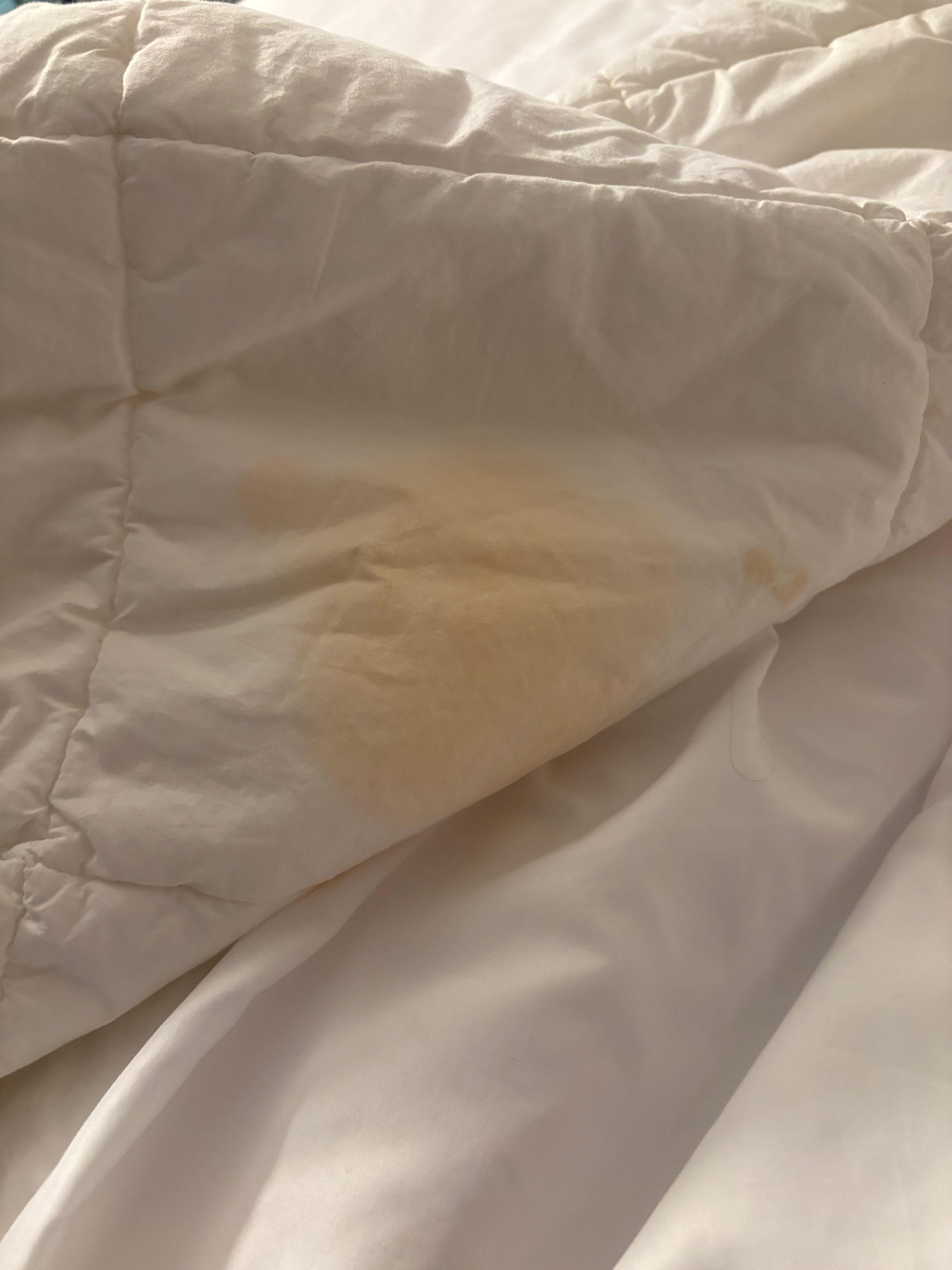 Stained bedding.