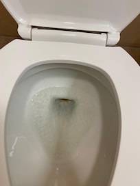 Toilet not clean, maybe use some chloride products available on the market