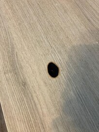 Bruciatura di sigaretta