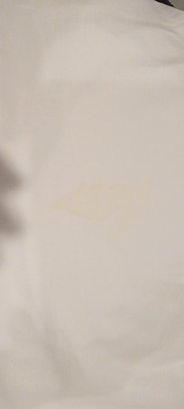 Yellow stain on pillow