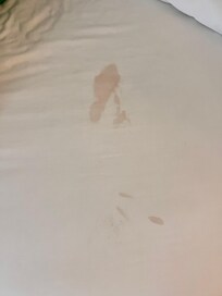 Blood stains on the bed