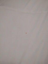 a blood stain on the bed by the window