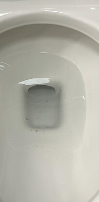 No matter how many times I flushed, pieces of feces kept coming up
