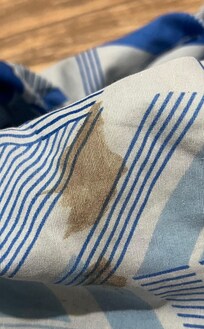 Menstruation stains on bed sheets