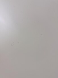 Black Hairs around the bathroom 3