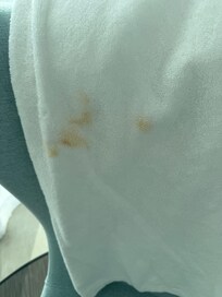 We asked for towels for our shower- this filthy stained towels are what they delivered. Hideous.