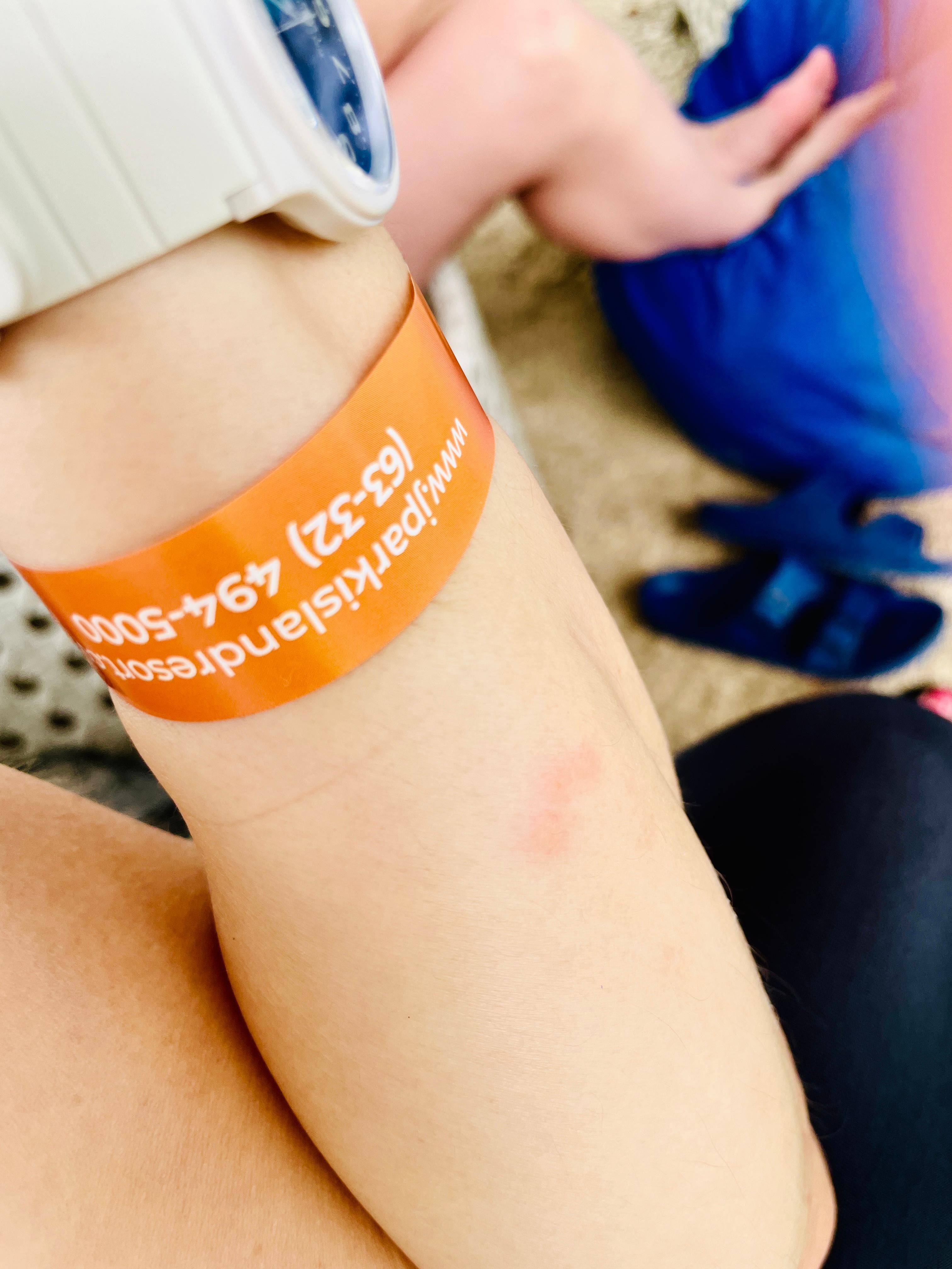 トコジラミ刺され後、宿泊3日