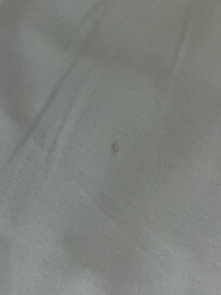toenail found in bed