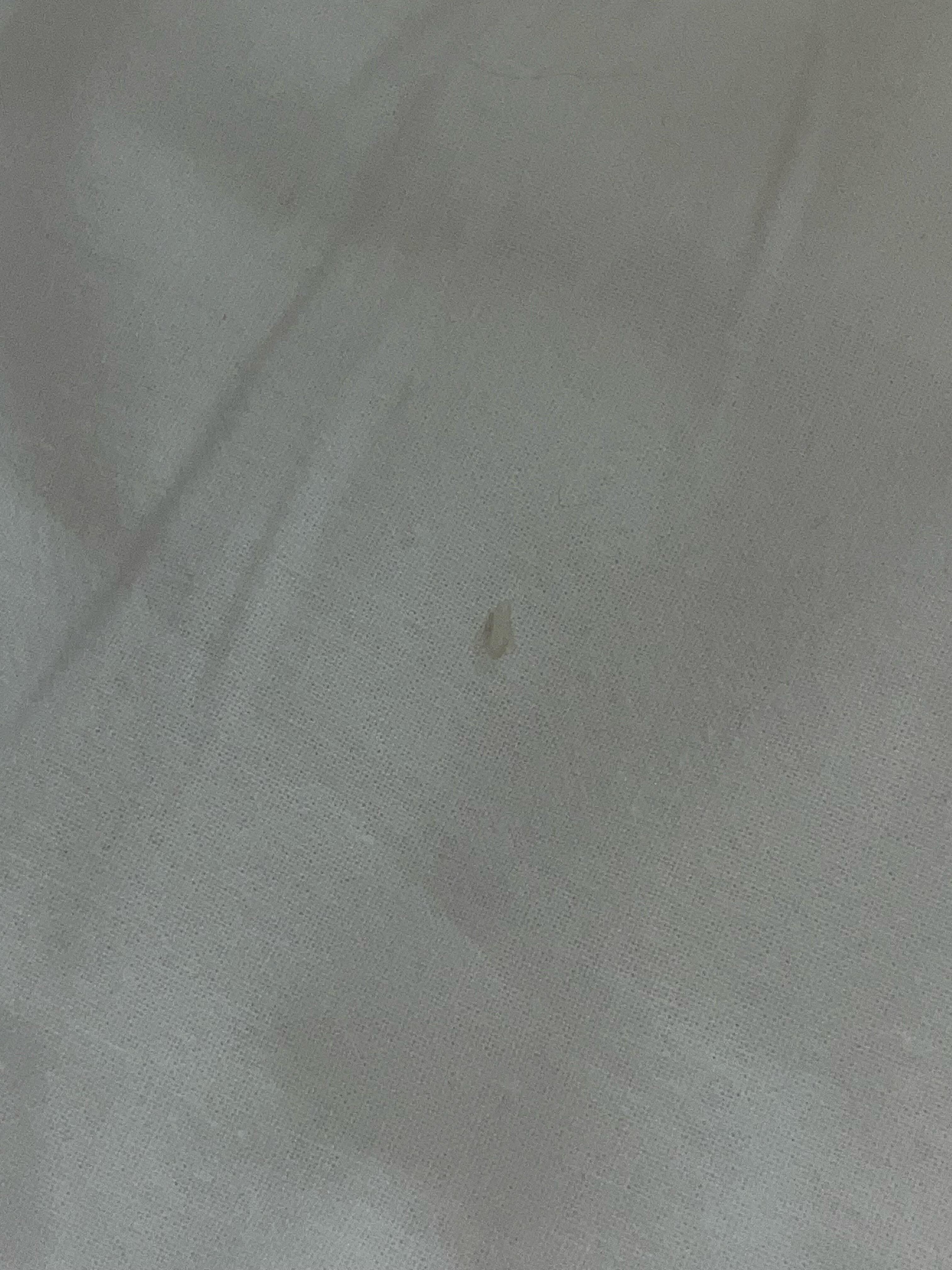 toenail found in bed