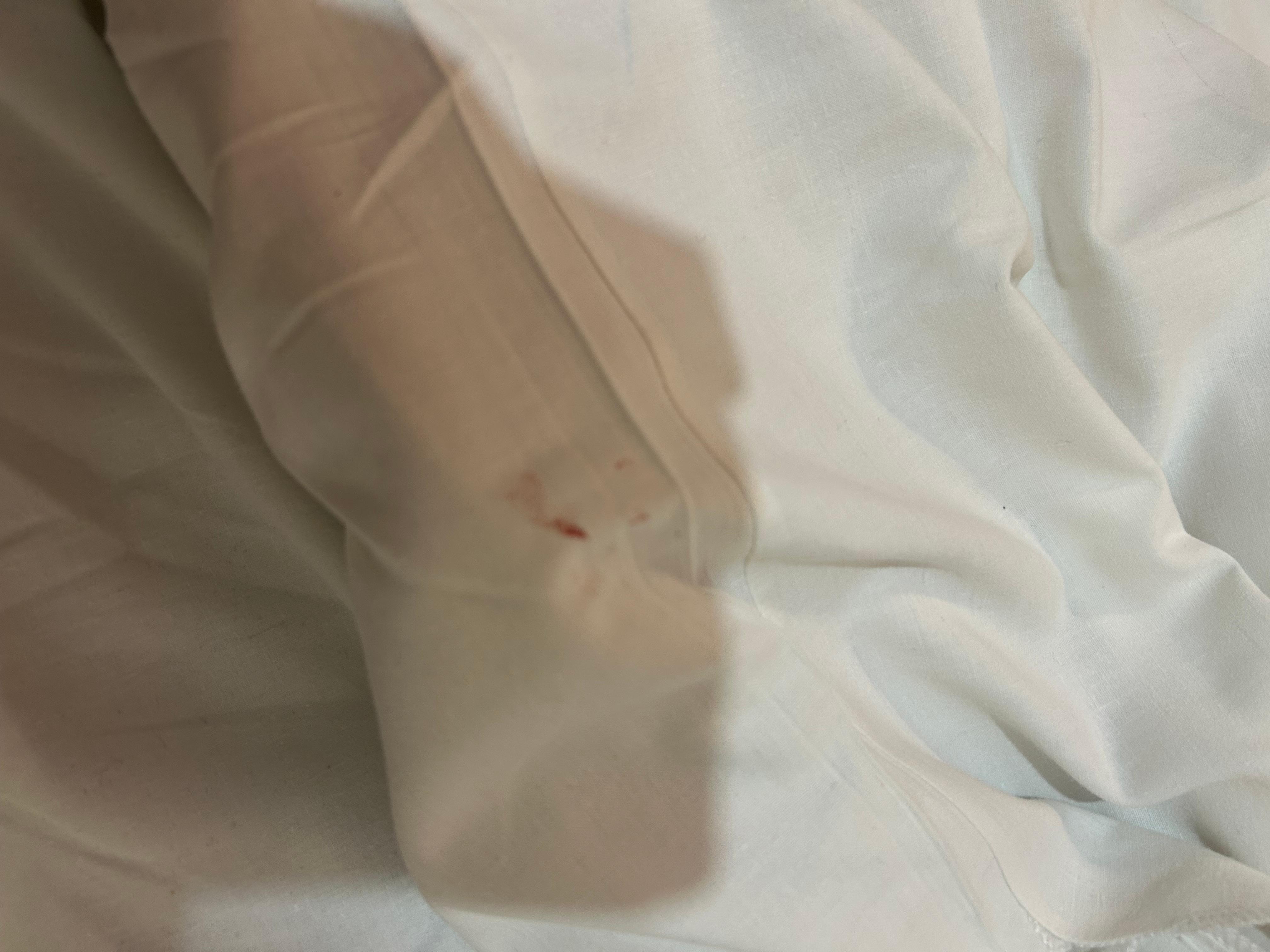 Dirty throughout. Shower stank of sewerage! I slept in my clean clothes, showered wearing socks (which I threw away after!