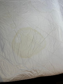 Blood stain , they replaced this sheet