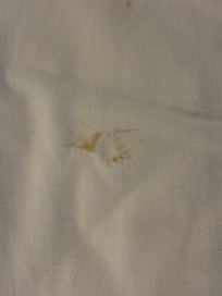 Stain on bedsheet