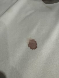 Blood on mattress