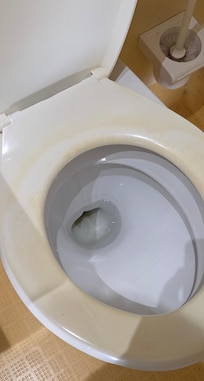 Ekelhafter Toilettensitz