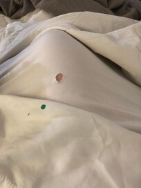 Holes in sheets