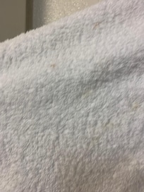 Stains on bath towel