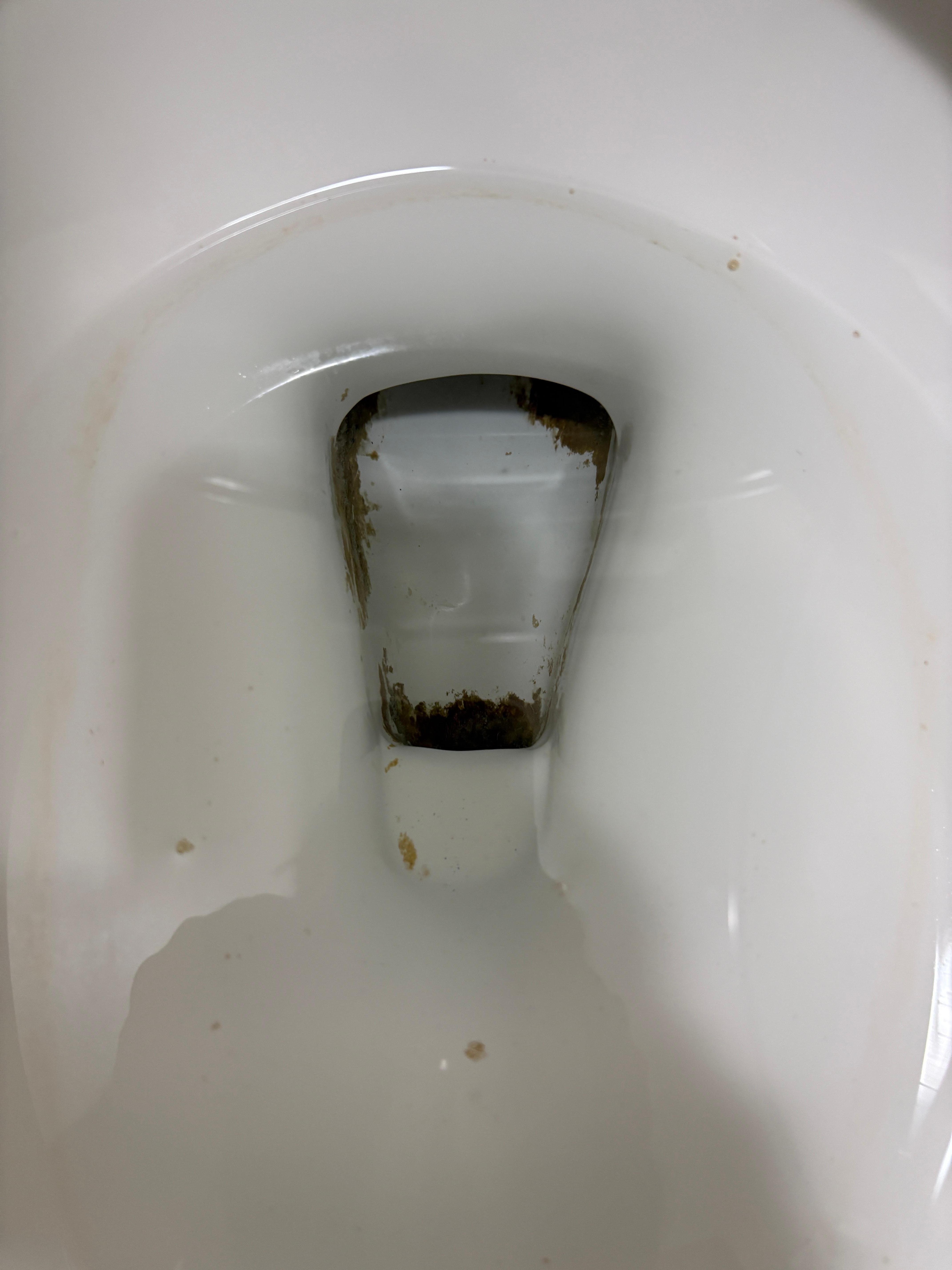 Poop