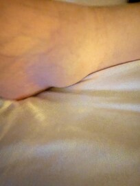 Picture of husbands ankle injury tub didn’t drain during shower tub very slippery