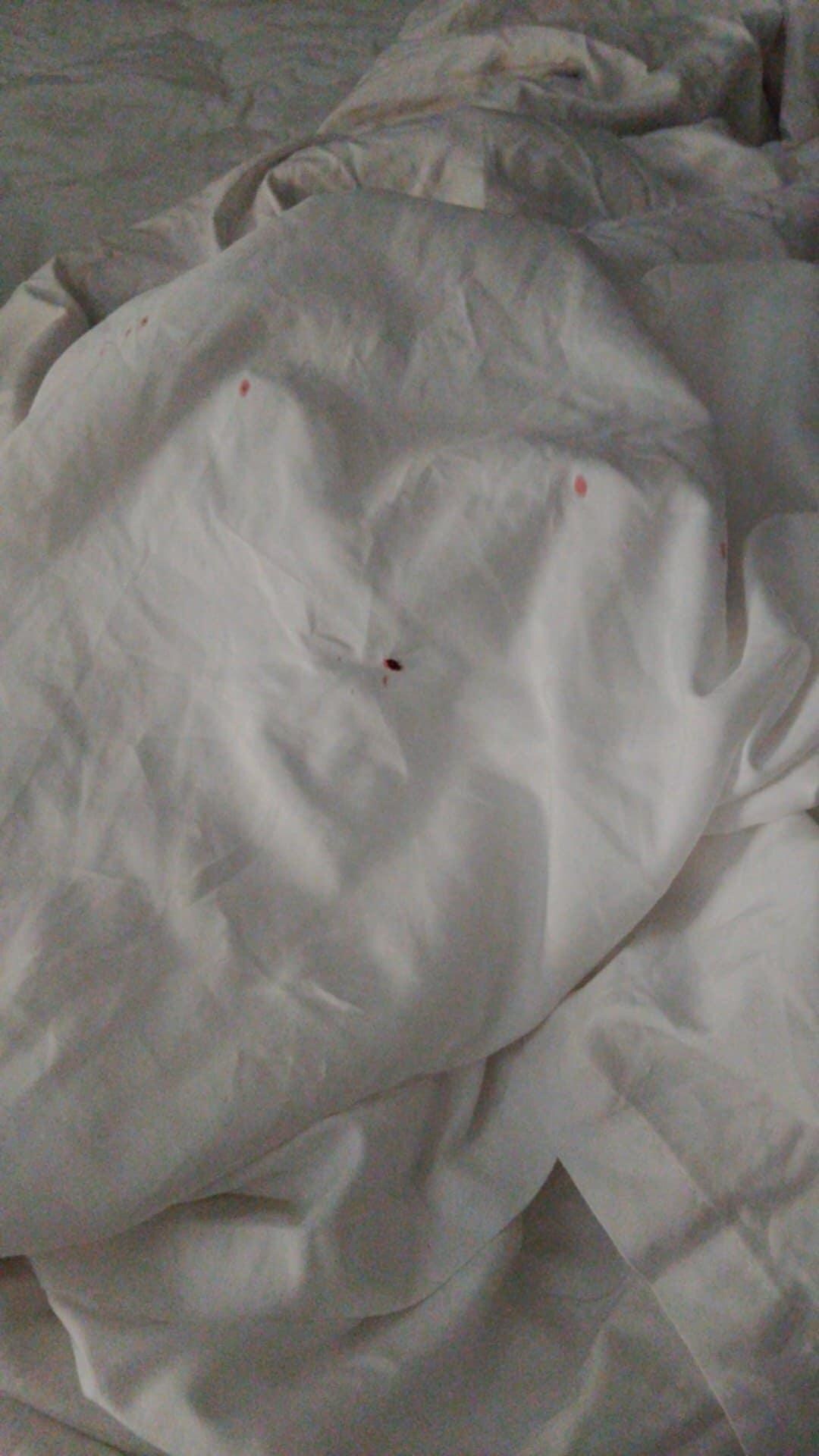 More bed bugs Pic 