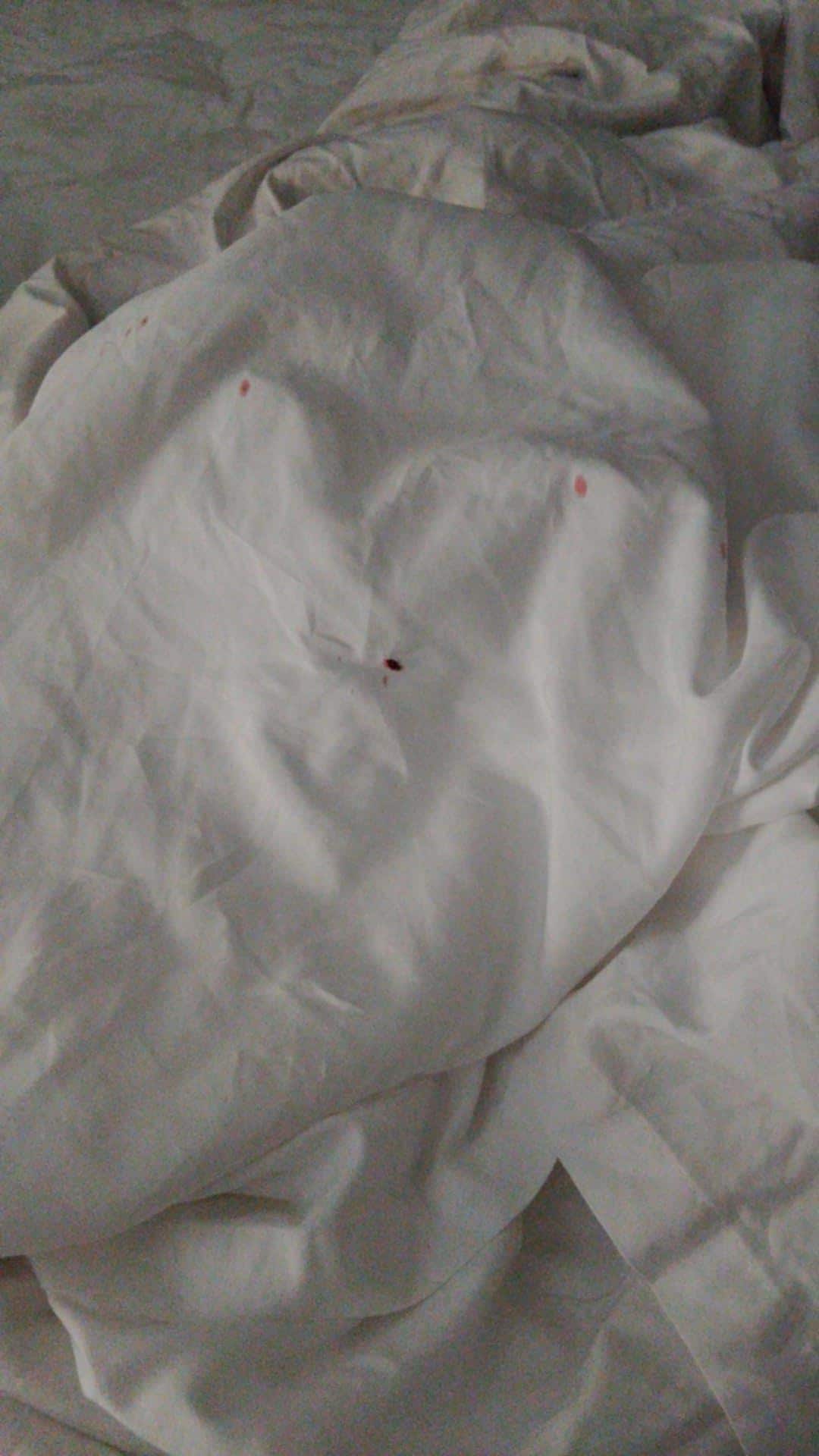 More bed bugs Pic