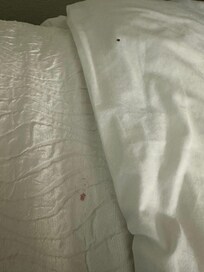 Blood on top sheet + sheet