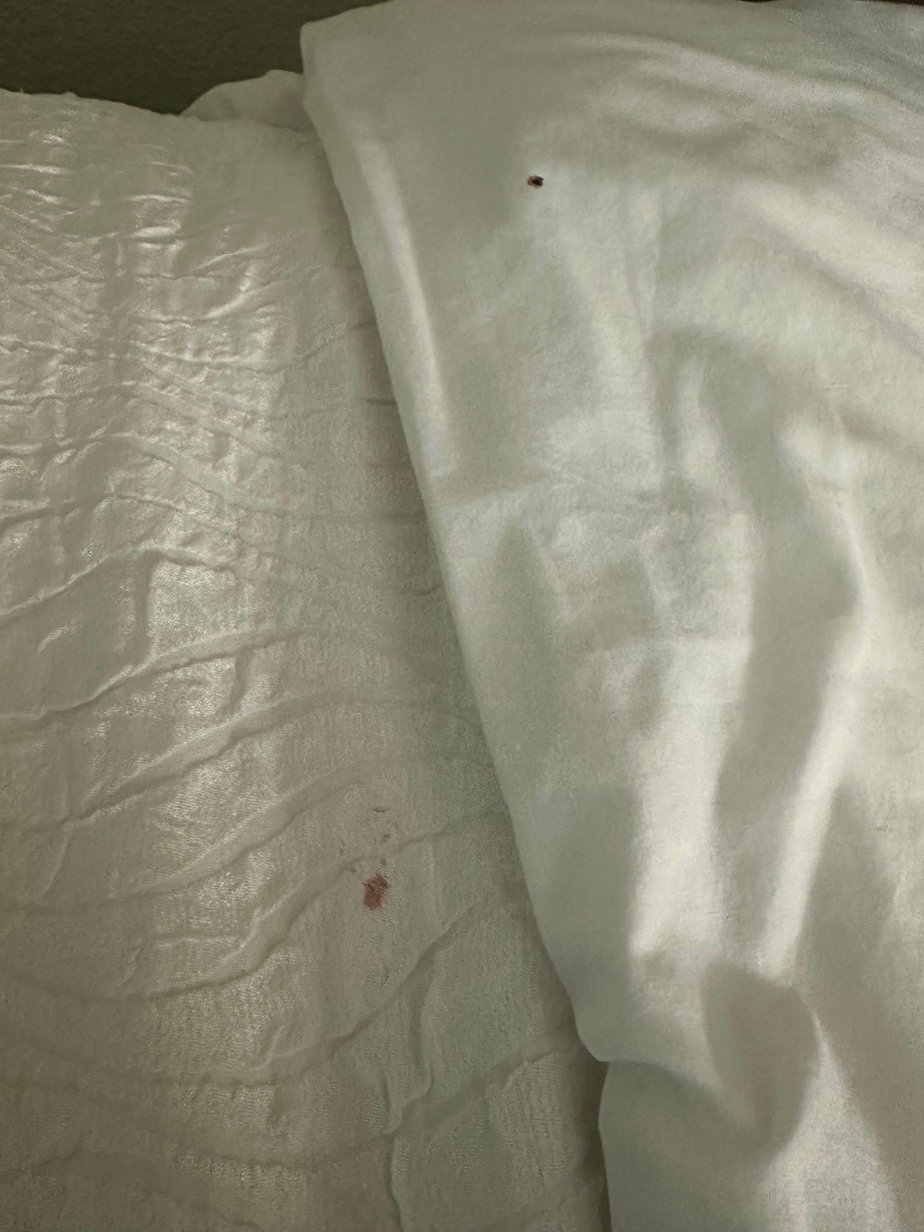 Blood on top sheet + sheet