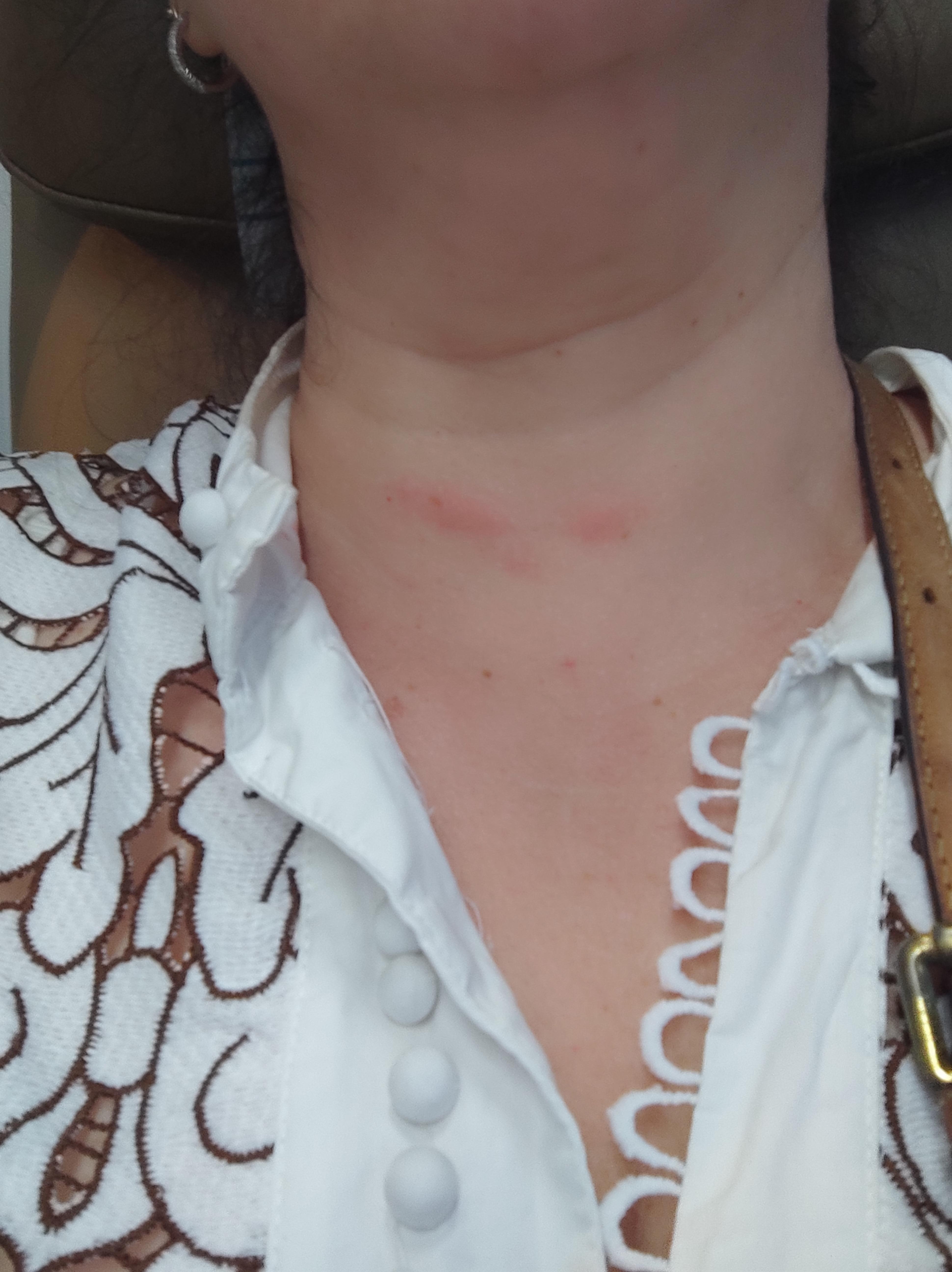 Bed bags bite,