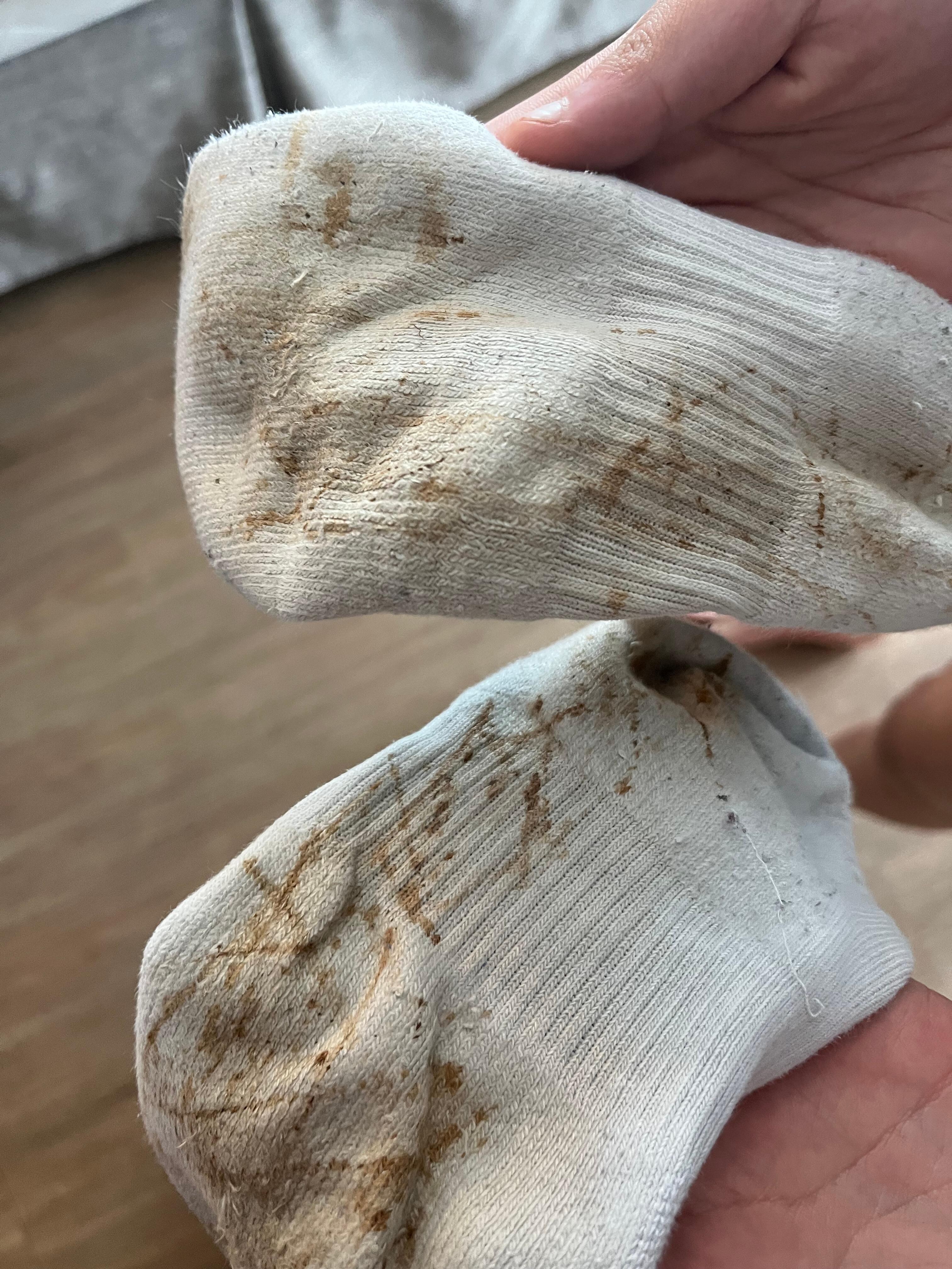 Ruined socks from rusty water leaking through floor