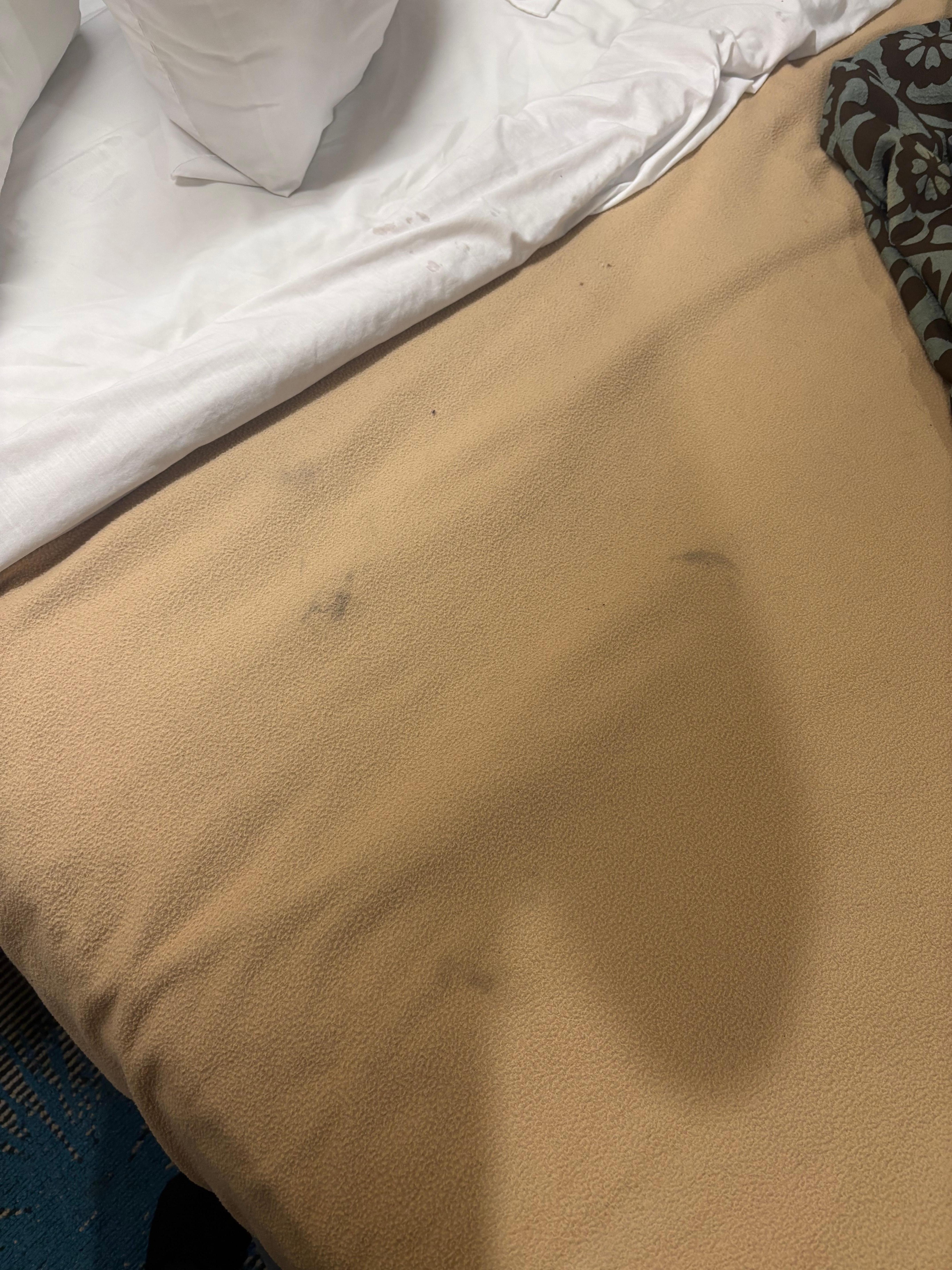 Machas en todas y cada una de la sabanas 