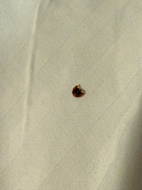 No alcancé a tomar foto de la cucaracha viva, pero aquí una muestra de que no es el único bicho que hay en las camas