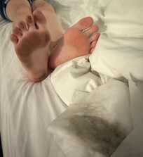 My daughter’s feet shortly after we got there from the carpet.
