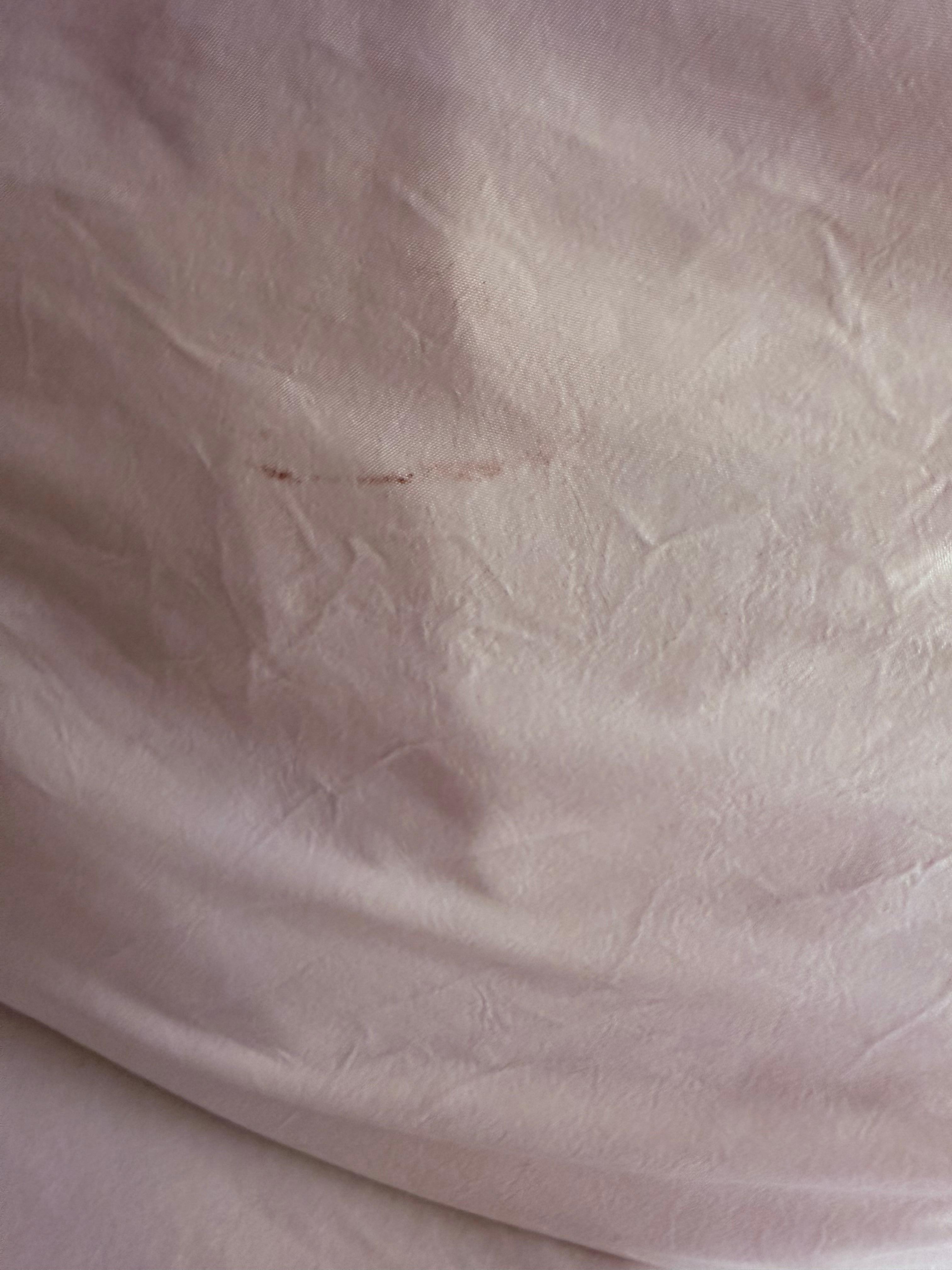 Stains on sheets