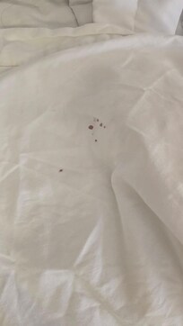 spot stained sheets