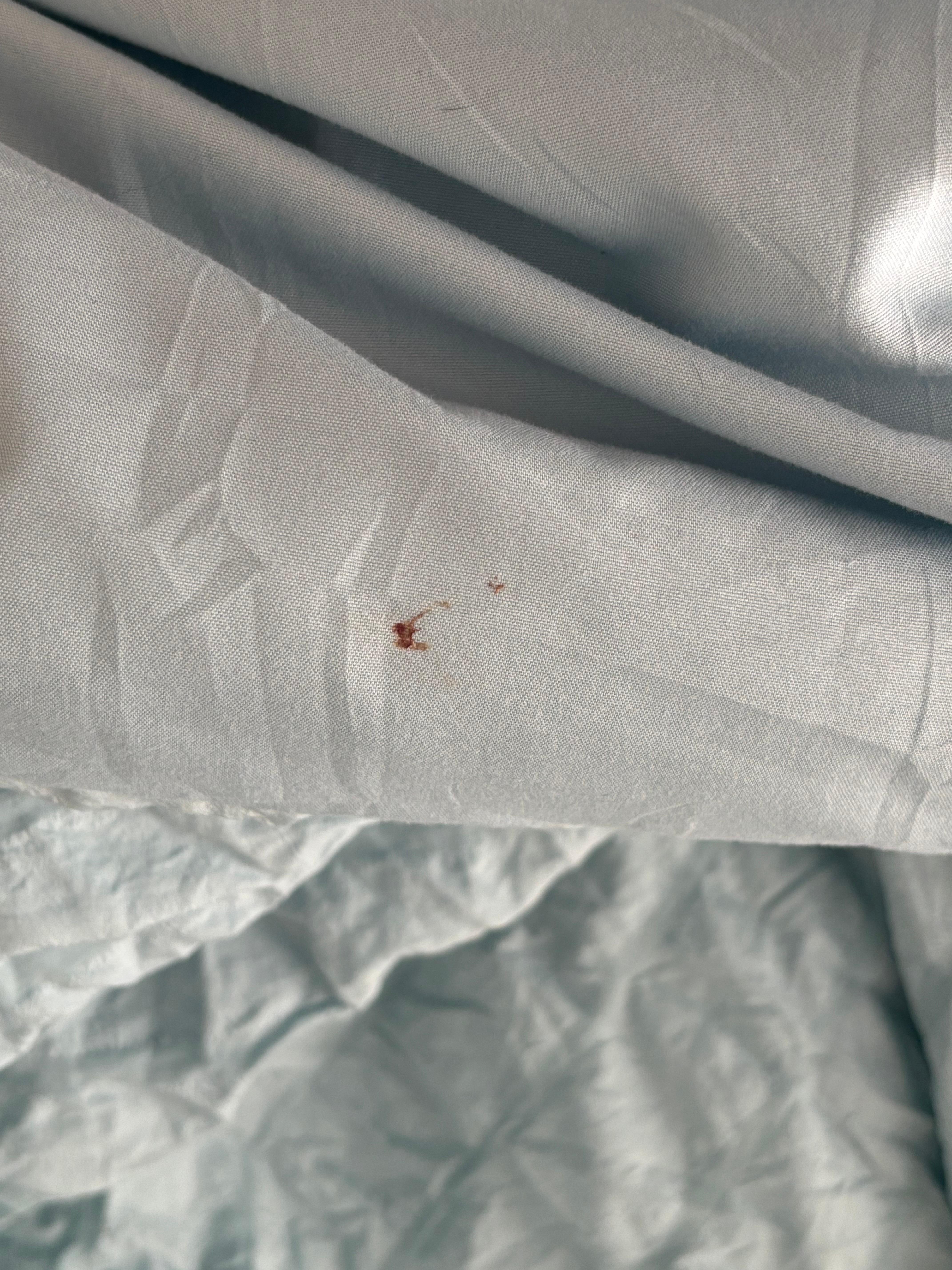 Booger / blood stain 