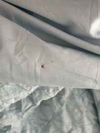 Booger / blood stain